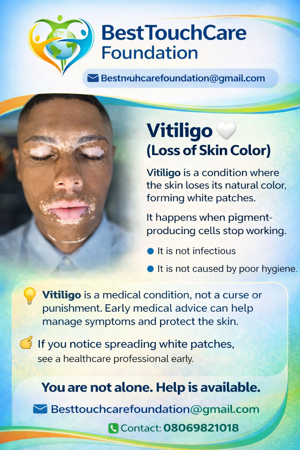 Vitiligo is not a curse or punishment stop the stigma
